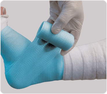 Splints & Casts - Cairns Hand Clinic