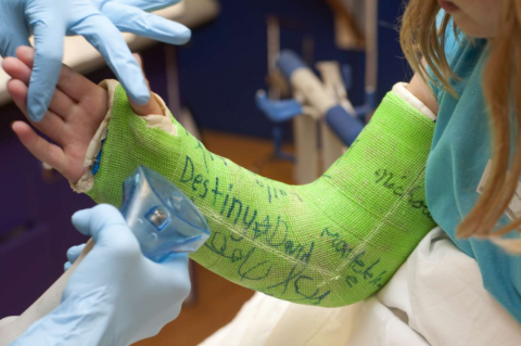 After Cast Removal - what to do after fracture cast removal