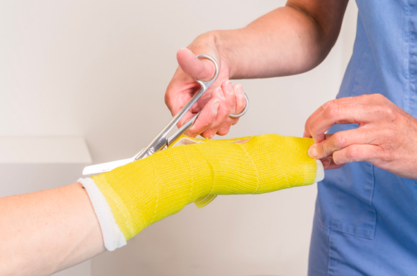 After cast Removal
