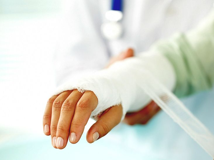 5th Metacarpal Fracture