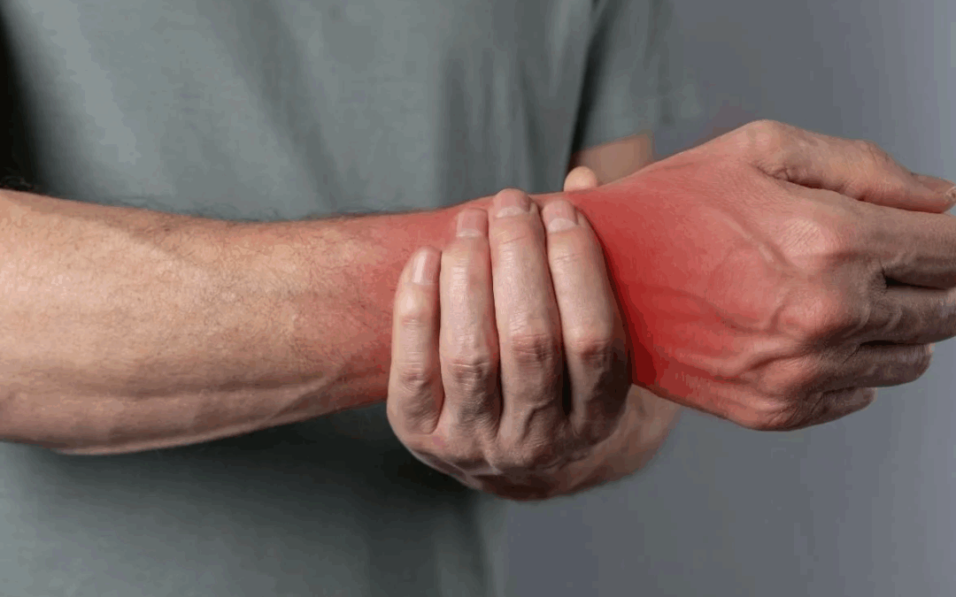 Hand Injuries