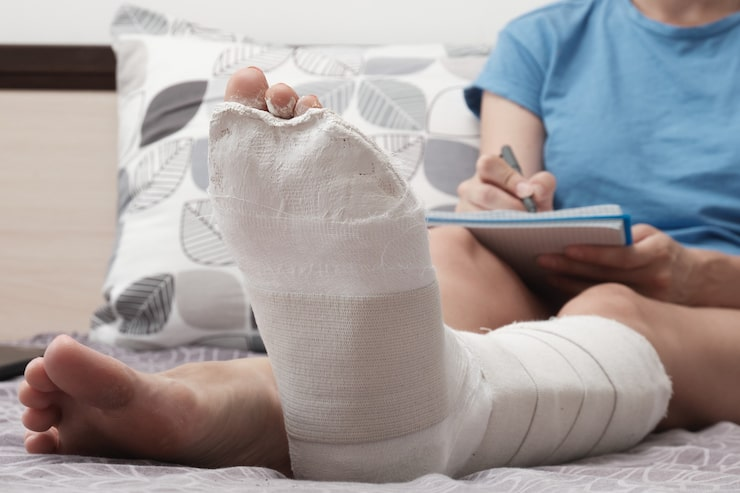 Fibula Fracture Treatment Brisbane Gold Coast Queensland Symptoms Diagnosis Causes Recovery Process 