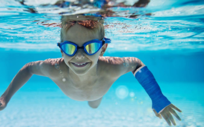 Need a waterproof cast on the Gold Coast or South Brisbane? Skip the long hospital queues. Visit The Fracture Clinic in Southport or Springwood for custom, water-safe orthopaedic casts.